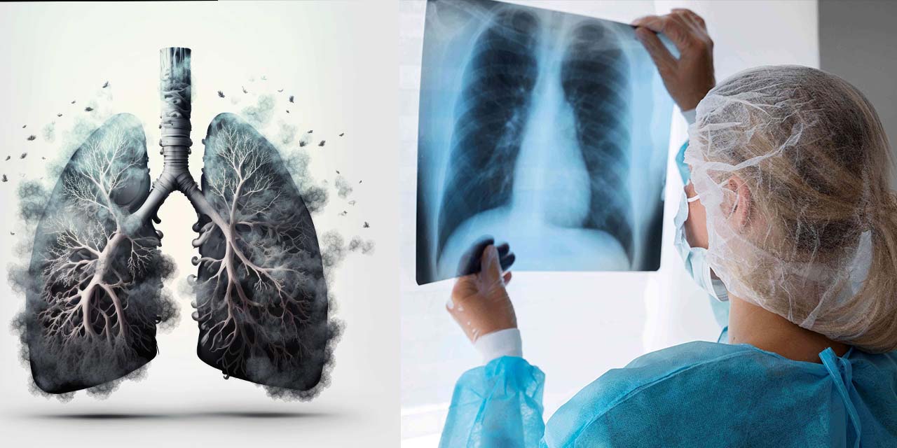 Dr. Balcı: “Akciğer Kanseri Büyük Ölçüde Önlenebilir!”